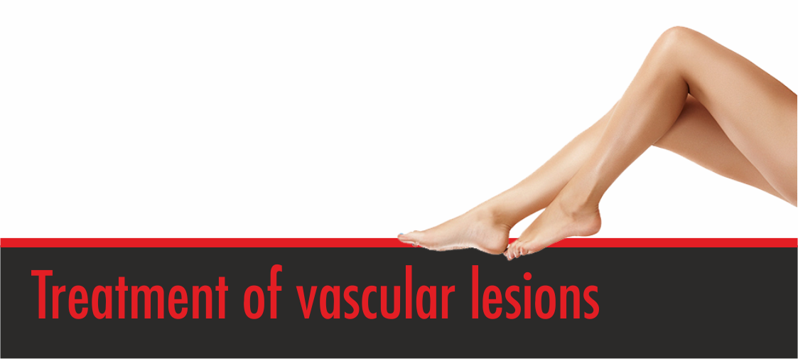 vascular_lesions